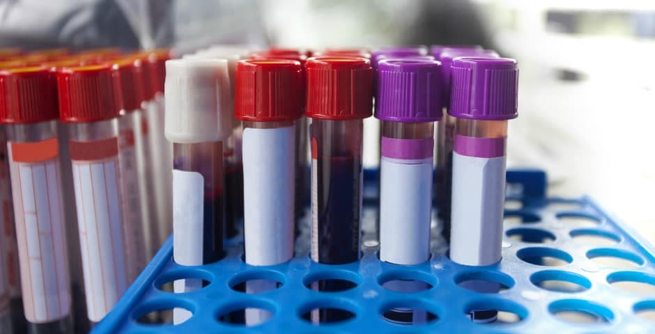 Provrör med blod.