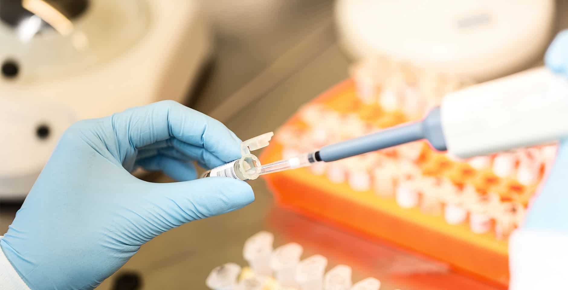 Forskare pipetterar ett prov på ett laboratorium.