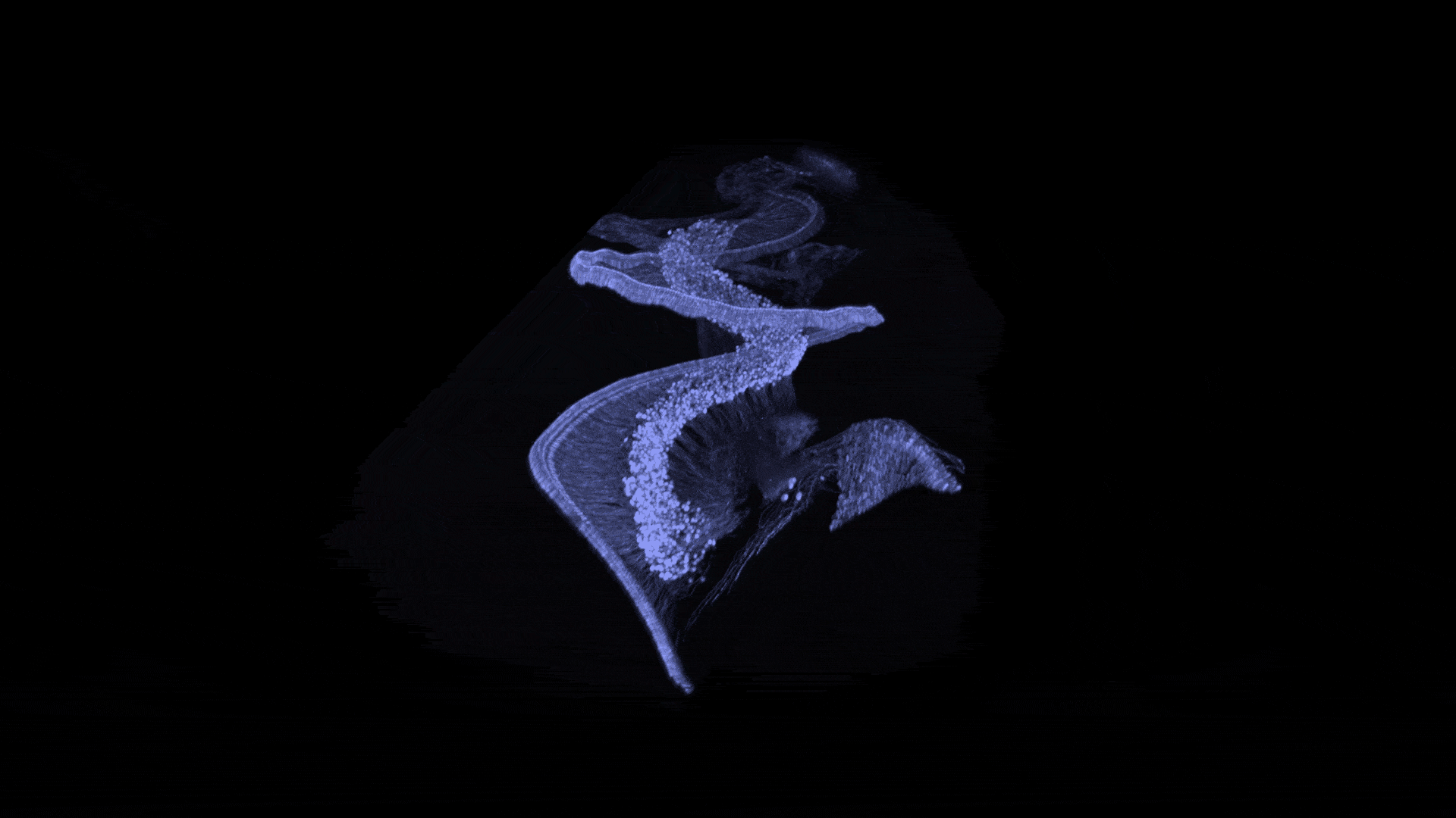 3D-bild av de neurosensoriska elementen i en mussnäcka strax efter födseln (nervceller i centrum och hårceller i periferin, med neuronfibrer som ansluter till dem).