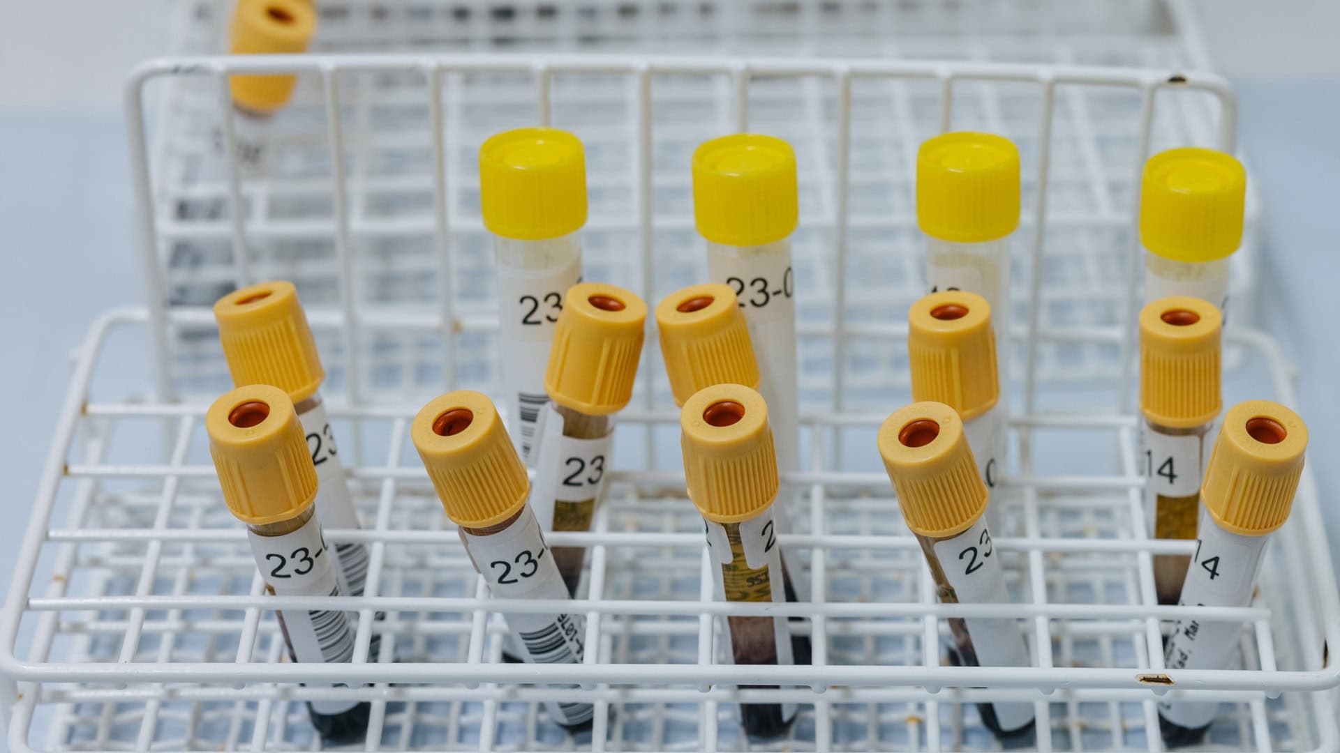 Prover från ALS-patienter i Caroline Ingres labb på KI.