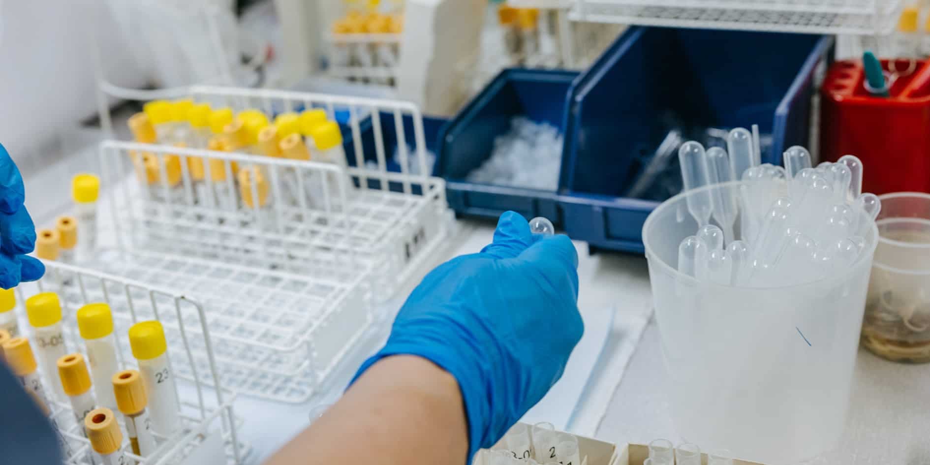 Hand i blå skyddshandske hanterar provrör och laboratorieutrustning på ett labb.